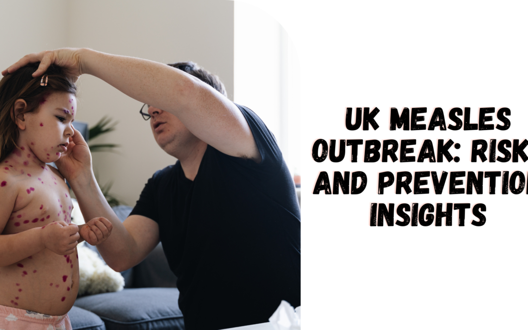 UK Measles Outbreak: Risks and Prevention Insights